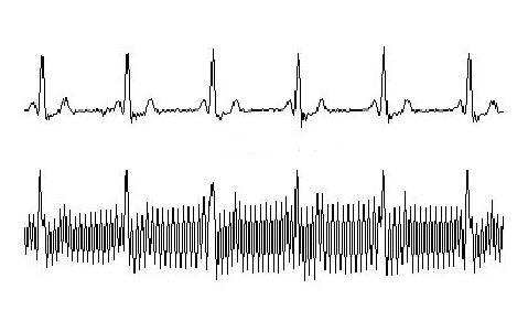 影响模拟量传感器的外界干扰因素和抗干扰措施