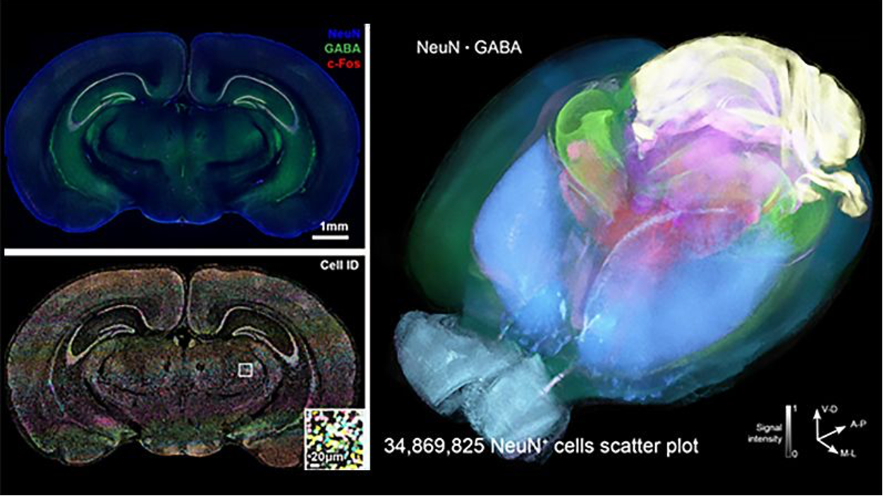 MATLAB 助力香港中文大学解决生物医学图像处理挑战